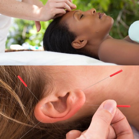 Acupuncture auriculaire, pour une santé de fer et un...