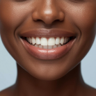 Soin Éclat Sourire – Blanchiment dentaire express – 20 min – KARIBBEAN SMILE